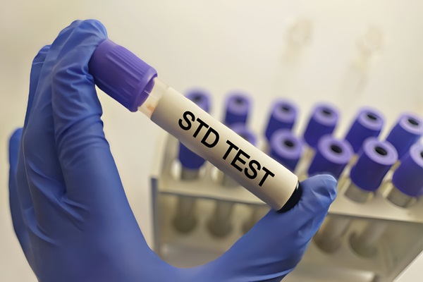 Methods for STD Testing - Texas Urgent Care & Imaging Center New Caney, TX